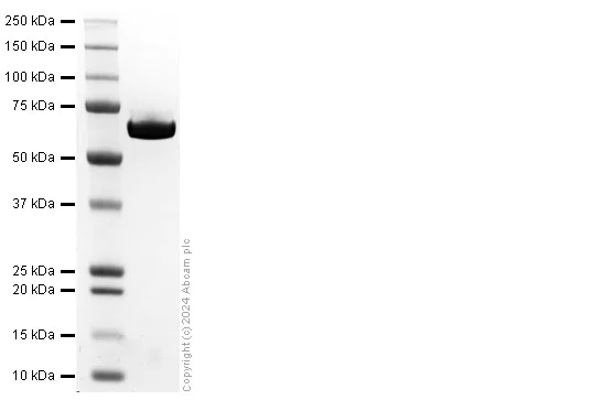 SDS-PAGE - Recombinant Clostridioides difficile Toxin B/TcdB Protein (His-tag) (AB318256)