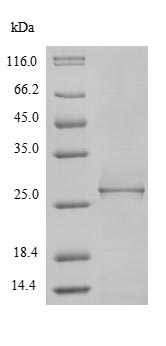 SDS-PAGE - Recombinant clpP2 protein (Tagged) (AB238223)
