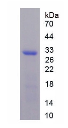 SDS-PAGE - Recombinant Collagen Type IV alpha 3 (COL4a3) (His tag) (AB275563)