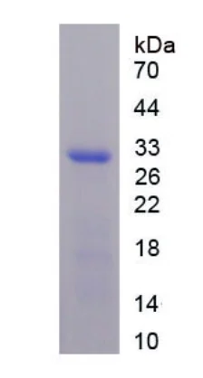 SDS-PAGE - Recombinant Collagen Type IV alpha 3 (COL4a3) protein (His tag) (AB275563)