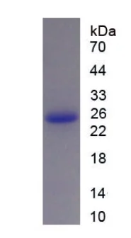 SDS-PAGE - Recombinant Cow Growth Hormone protein (His tag) (AB275561)