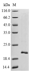 SDS-PAGE - Recombinant Cynomolgus monkey Prealbumin protein (His tag) (AB239566), expandable thumbnail
