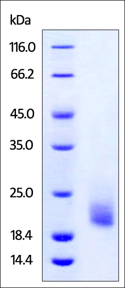 SDS-PAGE - Recombinant cynomolgus monkey TIGIT protein (Active) (AB223112)
