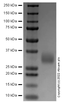 SDS-PAGE - Recombinant Cynomolgus monkey TREM2 protein (AB290833)