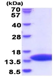 SDS-PAGE - Recombinant Dengue virus 2 Dengue Virus 2 envelope protein (His tag N-Terminus) (AB180271)