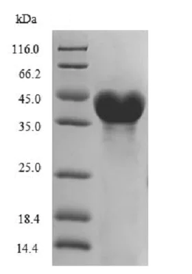 SDS-PAGE - Recombinant DNA ligase protein (His tag) (AB238366)