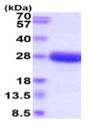 SDS-PAGE - Recombinant Dog IL-6 protein (His tag) (AB219480), expandable thumbnail