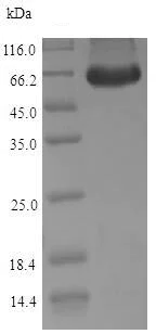 SDS-PAGE - Recombinant Dog PNLIPRP1 protein (His tag) (AB224870)