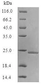 SDS-PAGE - Recombinant E. coli Aquaporin Z protein (Active) (AB235607)