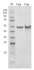 Recombinant E. coli ASS1 protein (Active)