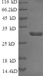 SDS-PAGE - Recombinant E. coli Beta-lactamase CTX-M-1 protein (His tag) (AB226272)