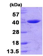 SDS-PAGE - Recombinant E. coli Beta-lactamase protein (His tag N-Terminus) (AB104926)