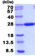 Recombinant E. coli Carbonic anhydrase 2/CA2 protein