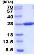 SDS-PAGE - Recombinant E. coli Carbonic anhydrase 2/CA2 protein (His tag N-Terminus) (AB208309)