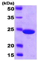 SDS-PAGE - Recombinant E. coli Carbonic anhydrase 2/CA2 protein (His tag N-Terminus) (AB87351)