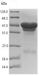 Recombinant E. coli Cytolethal distending toxin subunit B protein (Tagged)