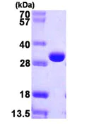 SDS-PAGE - Recombinant E. coli deoC protein (His tag N-Terminus) (AB106864)