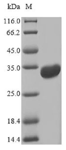 SDS-PAGE - Recombinant E. coli E. coli heat labile toxin A protein (Tagged) (AB236935)