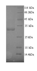 SDS-PAGE - Recombinant E. coli fimH protein (His tag) (AB238375)