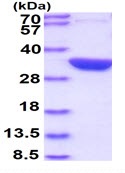 SDS-PAGE - Recombinant E. coli glsA1 protein (His tag N-Terminus) (AB107143)