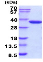 Recombinant E. coli Glucokinase protein (Active)