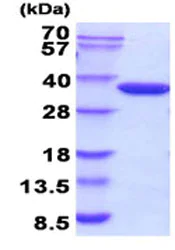 SDS-PAGE - Recombinant E. coli Glucokinase protein (Active) (His tag N-Terminus) (AB208303)