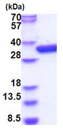 SDS-PAGE - Recombinant E. coli Glucokinase protein (His tag N-Terminus) (AB183231)