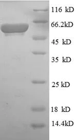 SDS-PAGE - Recombinant E. coli Glycerol 3 Phosphate Dehydrogenase protein (His tag) (AB235854)