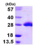 SDS-PAGE - Recombinant E. coli MSRA protein (AB106865)