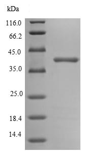 SDS-PAGE - Recombinant E. coli Outer membrane protein C (His tag) (AB236921)