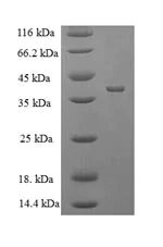 SDS-PAGE - Recombinant E. coli Protease 7 protein (His tag) (AB225585)