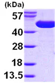 SDS-PAGE - Recombinant E. coli surA protein (His tag N-Terminus) (AB99241)