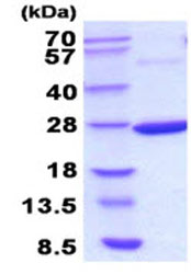 SDS-PAGE - Recombinant E. coli Thermosensitive gluconokinase protein (AB208297), expandable thumbnail