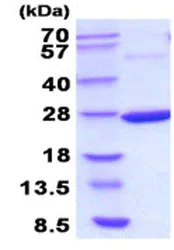 SDS-PAGE - Recombinant E. coli Thermosensitive gluconokinase protein (His tag N-Terminus) (AB208297)