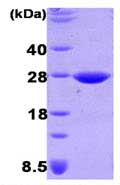 SDS-PAGE - Recombinant E. coli Thiol:disulfide interchange protein dsbG (AB87495)