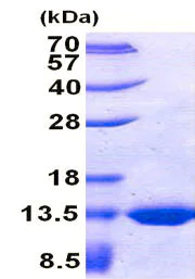 SDS-PAGE - Recombinant E. coli TST protein (His tag N-Terminus) (AB156746)