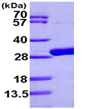 SDS-PAGE - Recombinant E. coli udp protein (His tag N-Terminus) (AB99262)