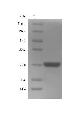 SDS-PAGE - Recombinant EBNA2 protein (Tagged) (AB241243)