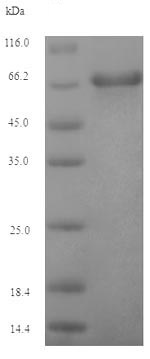 Recombinant EBV gp340/220 Envelope Protein (Tagged)