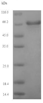 SDS-PAGE - Recombinant EBV gp340/220 Envelope Protein (Tagged) (AB237750)