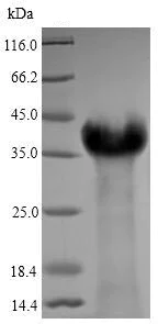 SDS-PAGE - Recombinant EBV Latent Membrane Protein 1 (His tag) (AB240835)