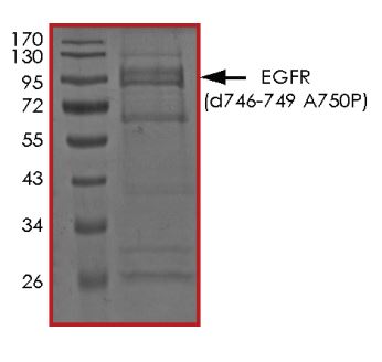 SDS-PAGE - Recombinant EGFR deletion 747-749 (mutated A750P) protein (Active) (AB268472), expandable thumbnail