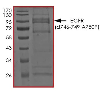 SDS-PAGE - Recombinant EGFR deletion 747-749 (mutated A750P) protein (Active) (AB268472)