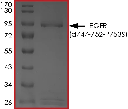SDS-PAGE - Recombinant EGFR (mutated P753S & del747-752) protein (Active) (AB268473)