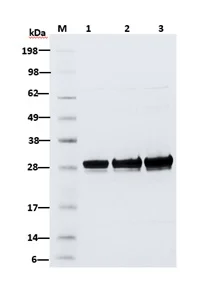 SDS-PAGE - Recombinant EN-TEV Protease protein (AB285976)