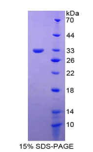 SDS-PAGE - Recombinant Follistatin (FS) (AB316919)