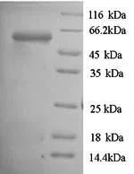 SDS-PAGE - Recombinant Gingipain R1 protein (His tag) (AB225982)