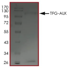 SDS-PAGE - Recombinant GST-TRK fused gene product-ALK fusion protein (Active) (AB269037)
