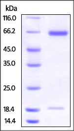 SDS-PAGE - Recombinant hamster PCSK9 protein (Active) (AB221332), expandable thumbnail