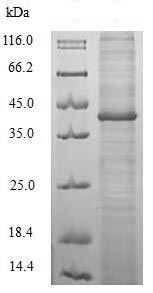 SDS-PAGE - Recombinant Helicobacter pylori CagA protein (Tagged) (AB224836)
